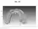 Fig. 05 - Method, apparatus and program for selective registration three-dimensional tooth image data to optical scanning tooth model