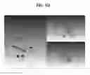 Fig. 10 - Method, apparatus and program for selective registration three-dimensional tooth image data to optical scanning tooth model