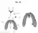 Fig. 12 - Method, apparatus and program for selective registration three-dimensional tooth image data to optical scanning tooth model