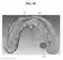 Fig. 14 - Method, apparatus and program for selective registration three-dimensional tooth image data to optical scanning tooth model
