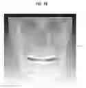 Fig. 16 - Method, apparatus and program for selective registration three-dimensional tooth image data to optical scanning tooth model