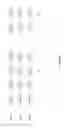 Fig. 22 - Inserting watermarks into audio signals that have speech-like properties