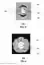 Fig. 03 - Transmission medium having multiple cores and methods for use therewith