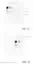Fig. 02 - Feature based high resolution motion estimation from low resolution images captured using an array source