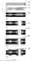 Fig. 04 - Method for manufacturing an ultra-thin metal layer printed circuit board