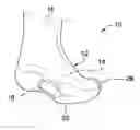 Fig. 01 - Orthopedic Sock