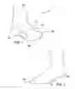 Fig. 02 - Orthopedic Sock