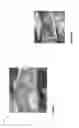 Fig. 07 - Removable Rubberized Pointe Shoe Caps For Non-Traditional Studio and Other Flooring