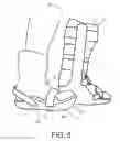 Fig. 06 - Shoe-lifting device