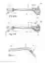 Fig. 06 - Endoscopic methods and devices for transnasal procedures