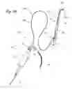 Fig. 22 - Endoscopic methods and devices for transnasal procedures