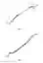 Fig. 04 - Nasal speculum