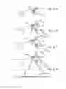 Fig. 04 - Methods and apparatus for treating disorders of the ear nose and throat