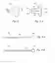Fig. 05 - Methods and apparatus for treating disorders of the ear nose and throat