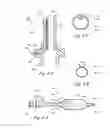 Fig. 07 - Methods and apparatus for treating disorders of the ear nose and throat