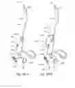 Fig. 34 - Methods and apparatus for treating disorders of the ear nose and throat