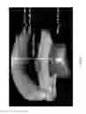 Fig. 11 - Optical coherence tomography systems and methods with dispersion compensation
