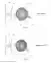 Fig. 02 - Capacitive sensors for determining eye gaze direction