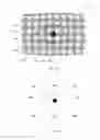 Fig. 06 - Capacitive sensors for determining eye gaze direction