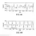 Fig. 10 - Defibrillator display