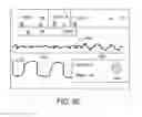 Fig. 14 - Defibrillator display