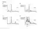Fig. 09 - Living body information sensor