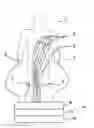 Fig. 01 - DATA PROCESSING APPARATUS FOR ASSESSING A CONDITION OF A MYOCARDIUM