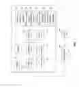 Fig. 02 - Method and system for assessing QRS components and the risk of ventricular arrhythmias