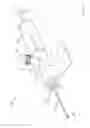 Fig. 03 - Methods and apparatus for selectively occluding the lumen of a needle