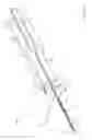 Fig. 17 - Methods and apparatus for selectively occluding the lumen of a needle