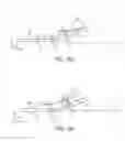 Fig. 22 - APPARATUSES FOR EXTERNALLY CONTROLLING ARTICULATION OF A JOINT MOTION