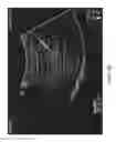 Fig. 05 - Ultrasound system for enhanced instrument visualization