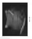 Fig. 07 - Ultrasound system for enhanced instrument visualization