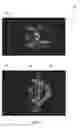 Fig. 08 - METHODS AND SYSTEMS FOR MEDICAL IMAGING SYSTEMS