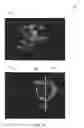 Fig. 09 - METHODS AND SYSTEMS FOR MEDICAL IMAGING SYSTEMS