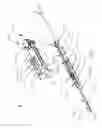 Fig. 02 - Biopsy device with translating valve member