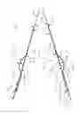 Fig. 35 - Biopsy device with translating valve member