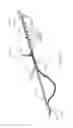 Fig. 45 - Biopsy device with translating valve member