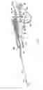 Fig. 09 - LENGTH DETECTION SYSTEM FOR BIOPSY DEVICE