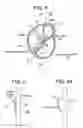 Fig. 02 - Patent foramen ovale closure method
