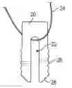Fig. 01 - Methods and systems for stitching soft tissue to bone