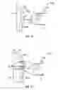 Fig. 07 - Methods and systems for stitching soft tissue to bone