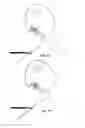 Fig. 09 - Suture-Passing Laparoscopic Knot Tying Instrument