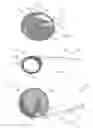 Fig. 06 - Devices and methods for the treatment of vascular defects