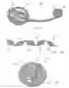 Fig. 10 - Devices and methods for the treatment of vascular defects