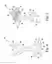 Fig. 03 - Oscillating rasp for use in an orthopaedic surgical procedure