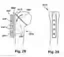 Fig. 16 - System and method for assisting with attachment of a stock implant to a patient tissue