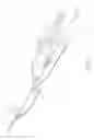 Fig. 03 - Axial lengthening thrombus capture system