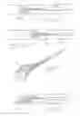 Fig. 06 - Endoscopic stone-extraction device