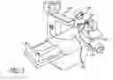 Fig. 02 - Methods and apparatus for treating disorders of the ear nose and throat